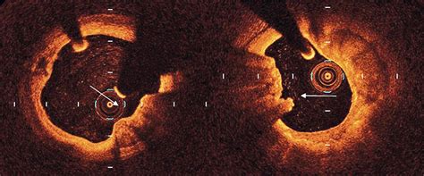 eruptive rs3|Eruptivo .